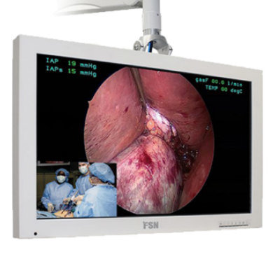 SURGICAL LCD SYSTEM