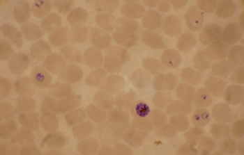 Imagen: Extendido de sangre de un cultivo de P. falciparum. Varios glóbulos rojos de la sangre muestran etapas de anillo en su interior, mientras que cerca del centro hay un esquizonte y a la izquierda un trofozoito (Fotografía cortesía de Wikimedia Commons).