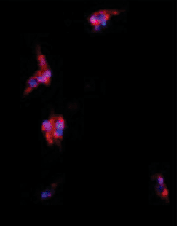 Imagen B: Presencia de la isoforma 4 de la caseína quinasa 1 (CK1.4) en Leishmania donovani mostrada mediante coloración immunoflourescente (rojo); la tinción de control de los núcleos se muestra en azul (Fotografía cortesía del Prof. C. L. Jaffe, de la Universidad Hebrea y de PLoS ONE ).