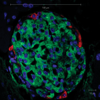 Imagen: Un islote pancreático de ratón tal como se observa por el microscopio de luz. Las células beta pueden ser reconocidas por la tinción verde de la insulina (Fotografía cortesía de Wikimedia Commons).
