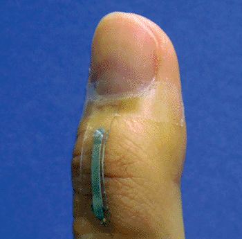 Imagen: Nanoalambres de plata montados en una articulación del pulgar para monitorizar la tensión de la piel (Fotografía cortesía de Shanshan Yao, NCSU).