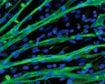 Imagen: Las células musculares están teñidas de verde en esta micrografía de las células cultivadas a partir de células madre embrionarias. Los núcleos celulares se ven teñidos de azul; las fibras musculares contienen varios núcleos. Los núcleos que se ven por fuera de las fibras verdes provienen de células diferentes a las musculares (Fotografía cortesía del Dr. Masatoshi Suzuki/Universidad de Wisconsin).