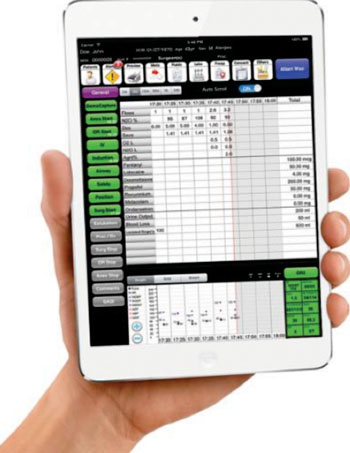 Imagen: El Anesthesia Touch mostrado en un iPad (Fotografía cortesía de Plexus IS).