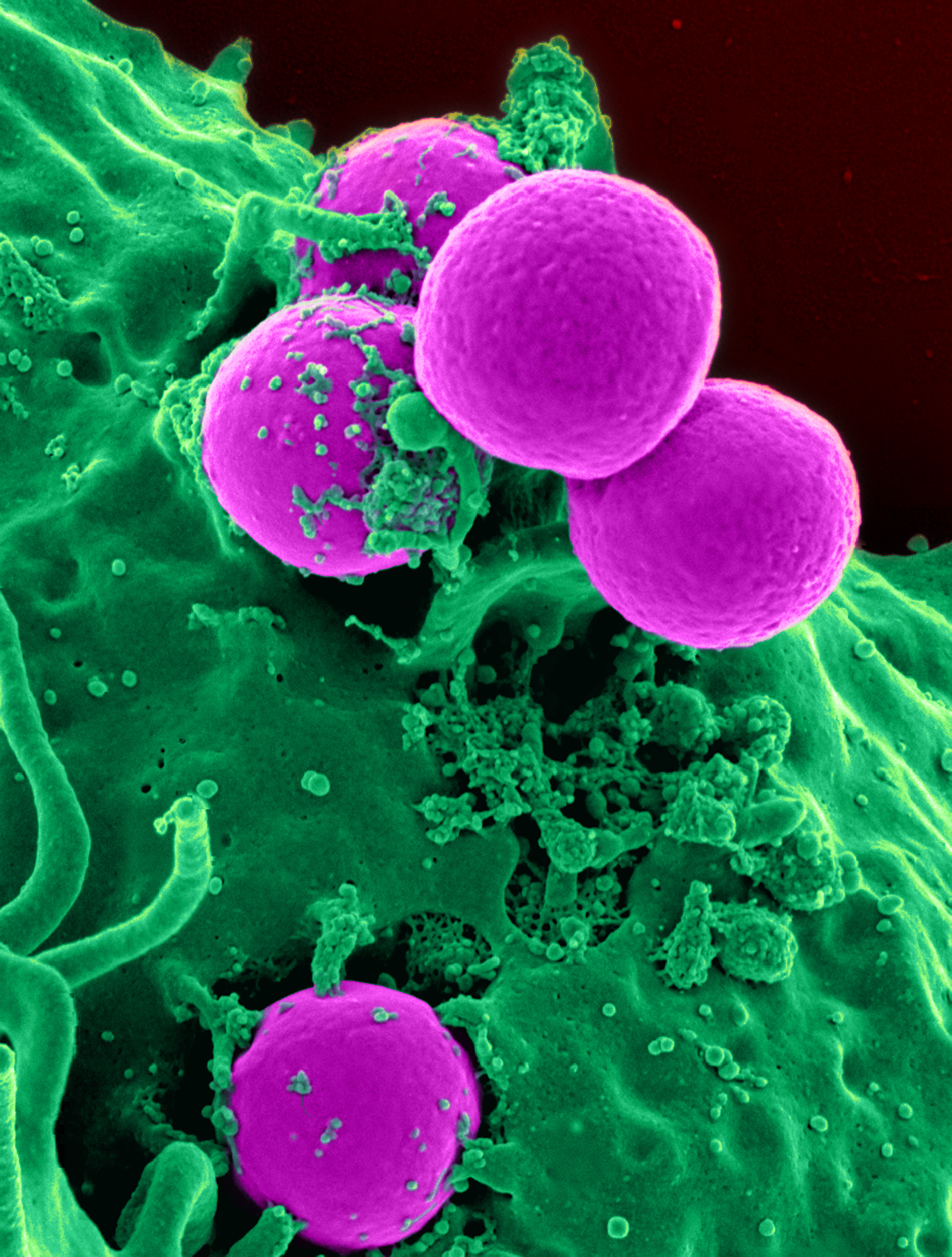 Imagen: Microfotografía electrónica de barrido de un neutrófilo humano ingiriendo SARM (Fotografía cortesía de los Institutos Nacionales de Salud (NIH) de los EUA/Wikipedia commons).