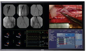 Imagen: La pantalla médica de 58 pulgadas MDSC-8258 (Fotografía cortesía de Barco).