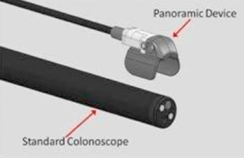 Imagen: El dispositivo panorámico Third Eye (Fotografía cortesía de Avantis Medical Systems).