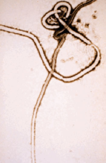 Imagen: Microfotografía electrónica de barrido (SEM) del virus del Ébola (Fotografía cortesía del CDC).