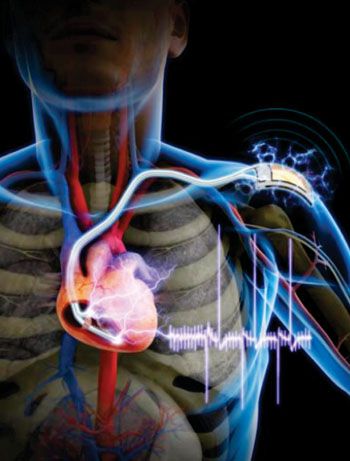 Imagen: Marcapasos cardiacos que recibe su energía mediante un recolector de energía piezoeléctrica flexible (Fotografía cortesía de KAIST).