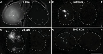 Imagen: Imágenes de fluorescencia de un hipocampo murino después de la difusión del dextrano a través de la BHE abierta mediante el FUS (izquierda), en comparación con la contralateral que muestra que no hay captación (derecha) (Fotografía cortesía de la Dra. Elisa Konofagou / Universidad de Columbia).