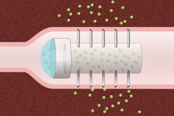 Imagen: Un dibujo esquemático de una pastilla de micro-agujas con agujas huecas (Fotografía cortesía de Christine Daniloff/MIT).