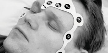 Imagen: Un conjunto de electrodos impresos para EEG mide la actividad eléctrica del cerebro (Fotografía cortesía de Pasi Lepola).