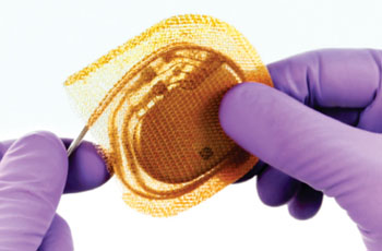 Imagen: La envoltura antibacteriana absorbible TYRX (Fotografía cortesía de Medtronic).