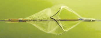 Imagen: El sistema de protección Wirion con filtro embólico distal (Fotografía cortesía de Allium Medical).