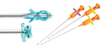 Imagen: Posibilidades para la detección de la osteoartritis descubiertas por el equipo Sackler (Fotografía cortesía del Instituto Nacional Estadounidense de Artritis y Enfermedades Musculoesqueléticas y de la Piel (NIAMS)).