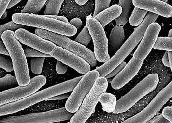 Imagen: Microfotografía electrónica de barrido (SEM) de Escherichia coli, obtenida de un cultivo (Fotografía cortesía del Instituto Nacional de Alergia y Enfermedades Infecciosas de los EE.UU.).