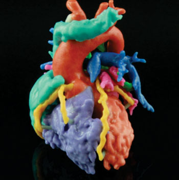 Imagen: Un corazón Materialise impreso en 3-D (Fotografía cortesía de Materialise).