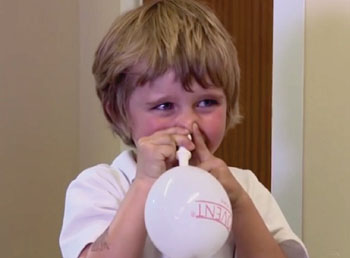 Imagen: Un niño con el globo nasal de inflado automático (Fotografía cortesía de la Universidad de Southampton).