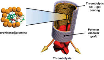 Imagen: Un activador del plasminógeno de tipo uroquinasa atrapado dentro de una película sol-gel de alúmina porosa (Fotografía cortesía de ITMO).