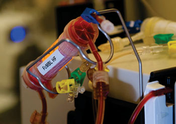 Imagen: El dispositivo para limpiar la sangre, FcMBL (Fotografía cortesía del Instituto Wyss de la Universidad de Harvard).