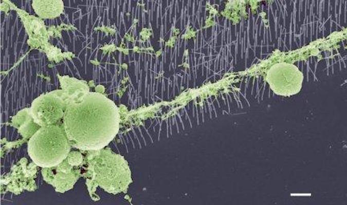 Imagen: Cúmulos de neuronas en los nano alambres (Fotografía cortesía de la Universidad de Lund).