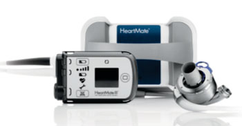 Imagen: El sistema de asistencia ventricular izquierdo HeartMate 3 (Fotografía cortesía de St. Jude Medical).