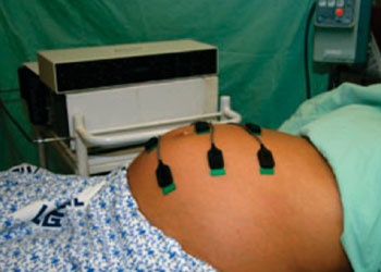 Imagen: El monitor materno-fetal TrueLabor (Fotografía cortesía de OB-Tools).