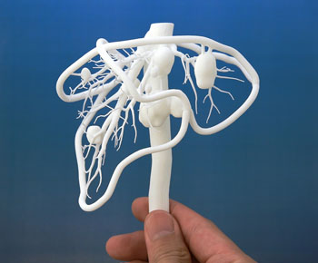 Imagen: Un modelo impreso en 3D de un hígado humano mostrando solo el suministro sanguíneo (Fotografía cortesía de DNP).
