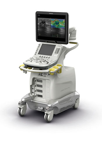 Imagen: El ARIETTA V70 con funciones mejoradas de elastografía (Fotografía cortesía de Hitachi Medical Systems).