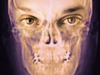 Imagen: Según nueva una investigación, la transposición nerviosa puede restablecer el tono facial y la simetría en los pacientes con parálisis facial (Fotografía cortesía de la UCLA / JAMA).
