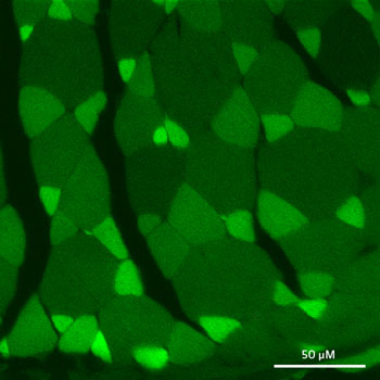 Imagen: La proteína fluorescente UnaG en las fibras musculares de las anguilas (Fotografía cortesía de RIKEN). Imagen: La proteína fluorescente UnaG en las fibras musculares de las anguilas (Fotografía cortesía de RIKEN).