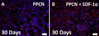Imagen: Coloración subdérmica CXCR-4 demostrando un aumento de la migración de células con PPCN+ SDF-1 (Fotografía cortesía de Guillermo Ameer).