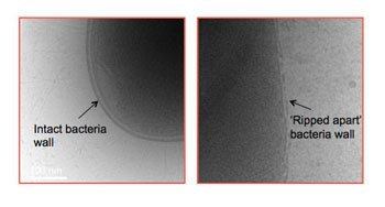 Imagen: Una célula bacteriana antes (I) y después del tratamiento (D) con polímeros en forma de estrella (Fotografía cortesía de UNIMELB).