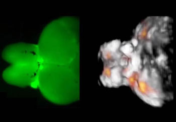 Imagen: Imágenes tomadas del cerebro de un pez cebra adulto –una imagen de fluorescencia a la izquierda, y una imagen de tomografía opto-acústica funcional a la derecha (Fotografía cortesía del Helmholtz Zentrum München). Imagen: Imágenes tomadas del cerebro de un pez cebra adulto –una imagen de fluorescencia a la izquierda, y una imagen de tomografía opto-acústica funcional a la derecha (Fotografía cortesía del Helmholtz Zentrum München).