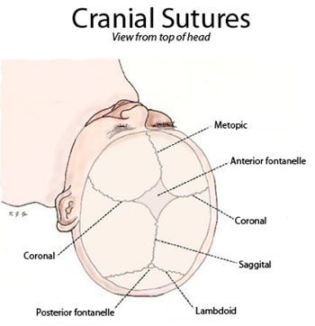 Imagen: Las suturas del cráneo, tal como se ven desde la parte superior de la cabeza (Fotografía cortesía de Wikimedia).