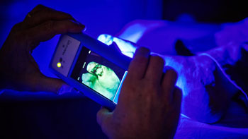 Imagen: El dispositivo de mano MolecuLight i:X, utiliza imágenes de fluorescencia para identificar bacterias (Fotografía cortesía de MolecuLight).
