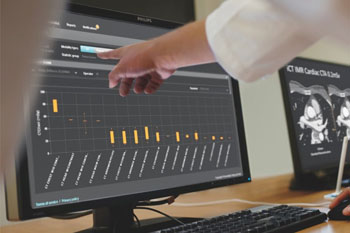 Imagen: El Portal DoseWise 2.2 (Fotografía cortesía de Philips Healthcare).