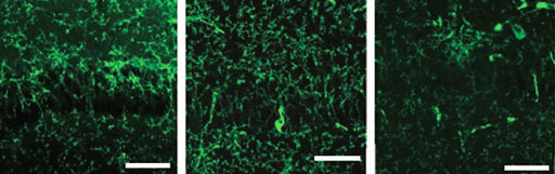 Imagen: Los péptidos Aβ en el cerebro de un ratón, después de la estimulación optogenética y de oscilaciones gamma (Fotografía cortesía de MIT).
