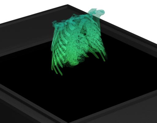Imagen: Una visualización holográfica de los pulmones (Fotografía cortesía de Holoxica).