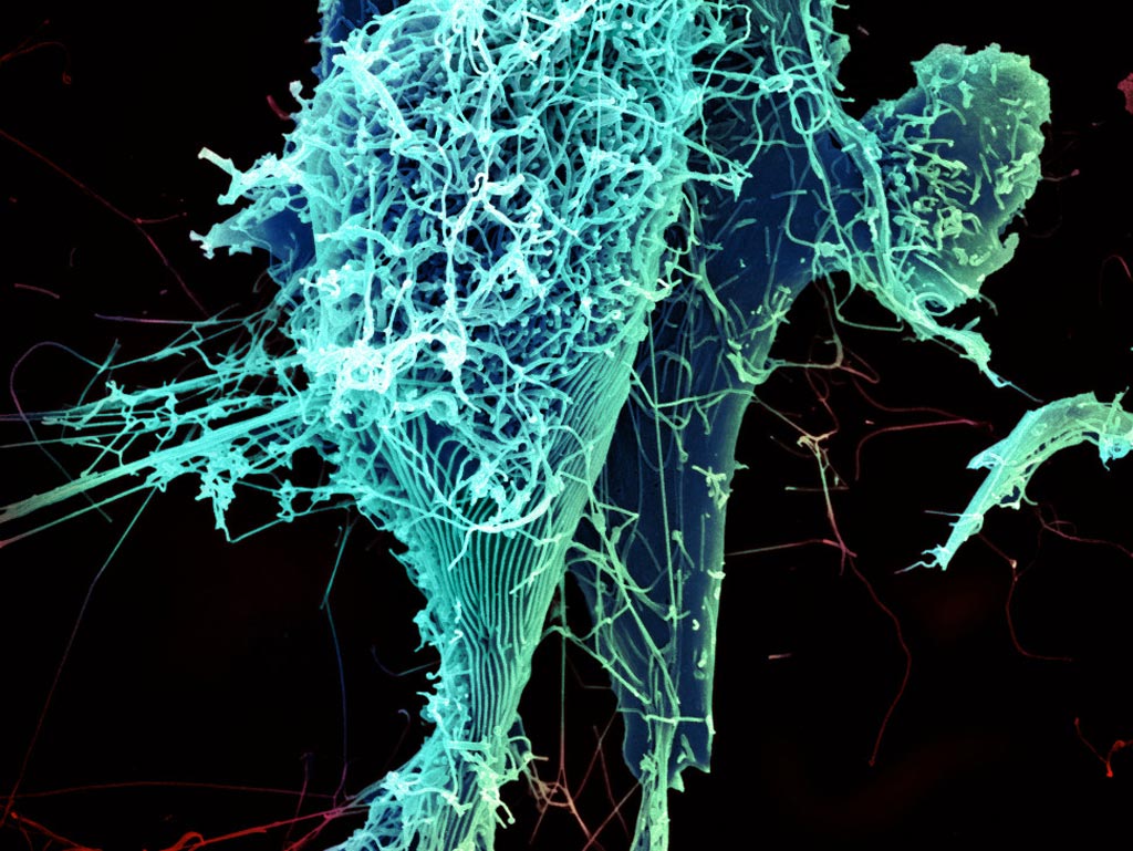 Imagen: Una célula infectada englobada por el Ébola (Fotografía cortesía del Instituto Nacional de Alergias y Enfermedades Infecciosas, Institutos Nacionales de Salud).