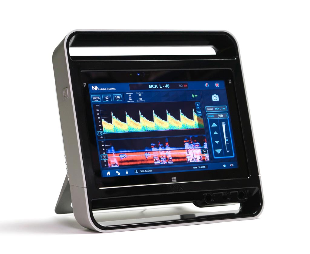 Imagen: El sistema de ultrasonido doppler transcripcional Lucid M1 (Fotografía cortesía de Neural Analytics). Imagen: El sistema de ultrasonido doppler transcripcional Lucid M1 (Fotografía cortesía de Neural Analytics).