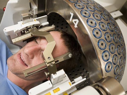 Imagen: Un paciente a quien le practican una SRS posterior a una cirugía del cerebro (Fotografía cortesía de DioMedia). Imagen: Un paciente a quien le practican una SRS posterior a una cirugía del cerebro (Fotografía cortesía de DioMedia).