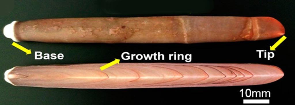 Imagen: Un nuevo estudio afirma que las espinas de erizo de mar se pueden utilizar para formar implantes de hueso biodegradable (Fotografía cortesía de la ACS).