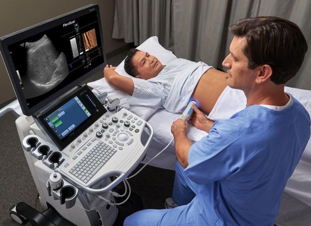 Imagen: El nuevo sistema integrado de manejo de la enfermedad hepática, LOGIQTM S8 XDclearTM 2.0, en operación (Fotografía cortesía de GE Healthcare / Echosens). Imagen: El nuevo sistema integrado de manejo de la enfermedad hepática, LOGIQTM S8 XDclearTM 2.0, en operación (Fotografía cortesía de GE Healthcare / Echosens).