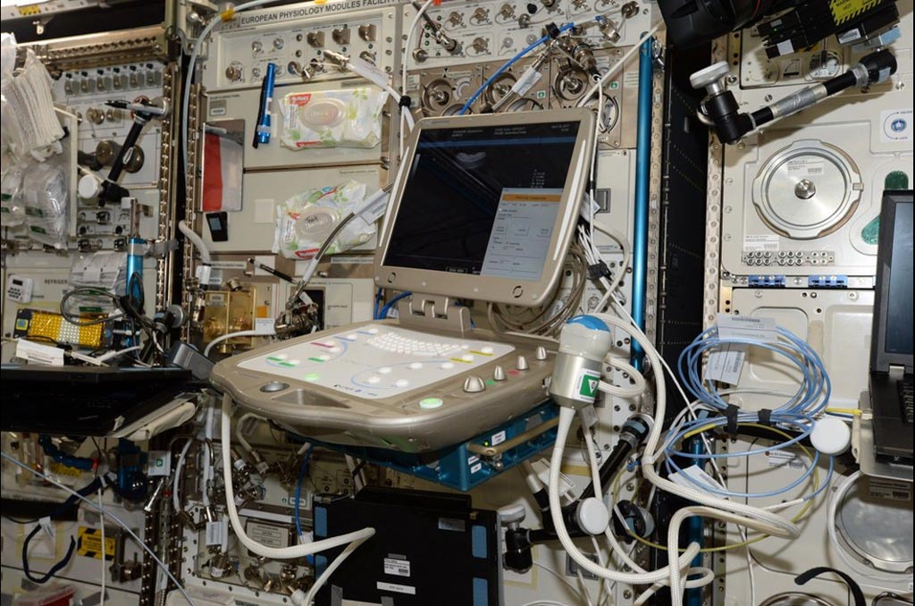 Imagen: El sistema Orcheo Lite TE fue utilizado en la Estación Espacial Internacional (Fotografía cortesía de la NASA/Sonoscanner). Imagen: El sistema Orcheo Lite TE fue utilizado en la Estación Espacial Internacional (Fotografía cortesía de la NASA/Sonoscanner).