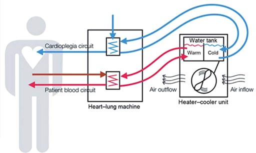 Imagen: La investigación muestra que las unidades de calefacción-enfriamiento pueden albergar muchos patógenos peligrosos (Fotografía cortesía de la FDA).