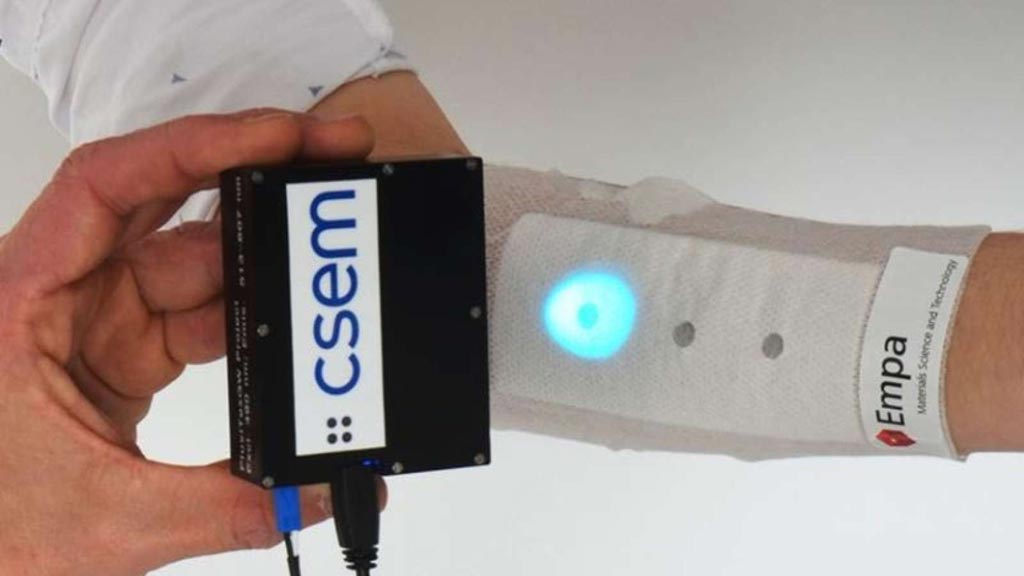 Imagen: Utilizando una lámpara UV, se puede verificar el nivel de pH en una herida sin quitar el vendaje (Fotografía cortesía del Empa/CSEM).
