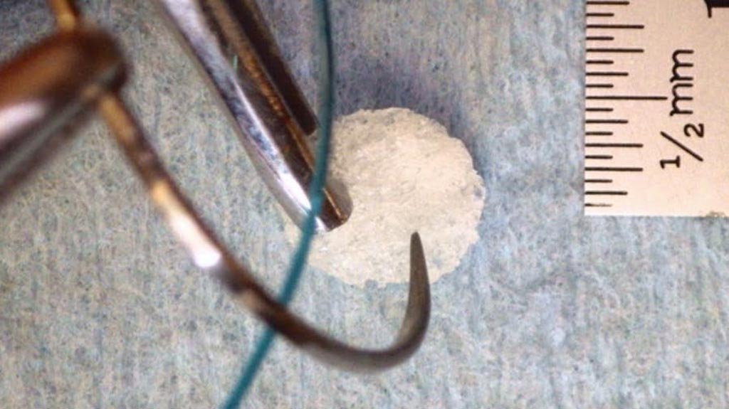 Imagen: Una barrera de disolución rápida podría proteger los tejidos durante el cierre laparoscópico (Fotografía cortesía de la Universidad de Cornell).