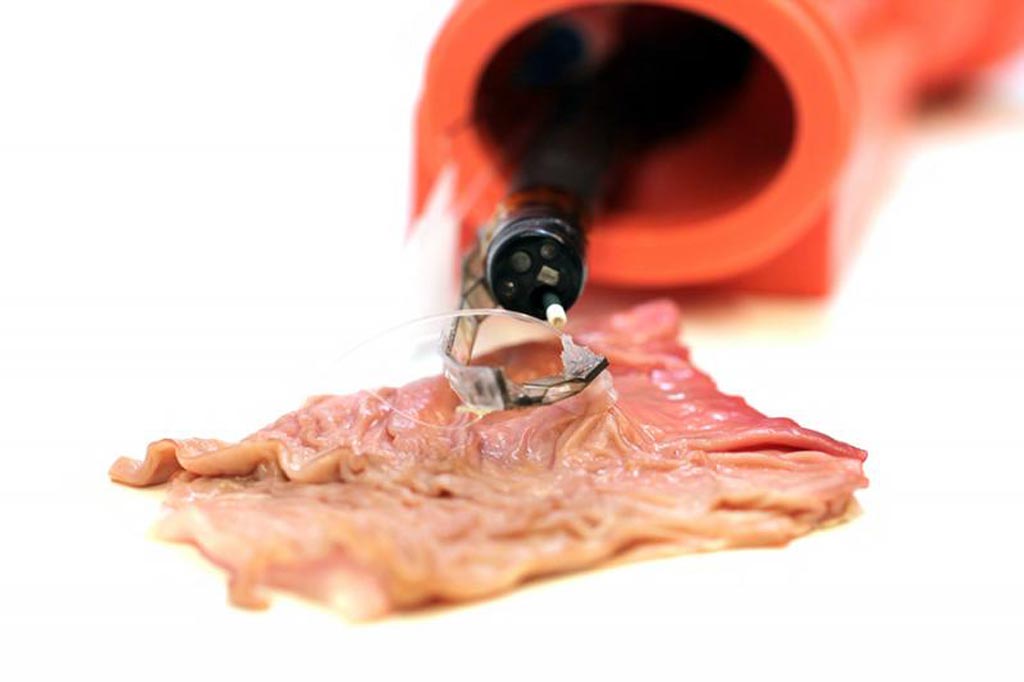 Imagen: Un brazo realizando la contra-tracción del tejido en un estómago porcino (imagen cortesía del instituto de Wyss).