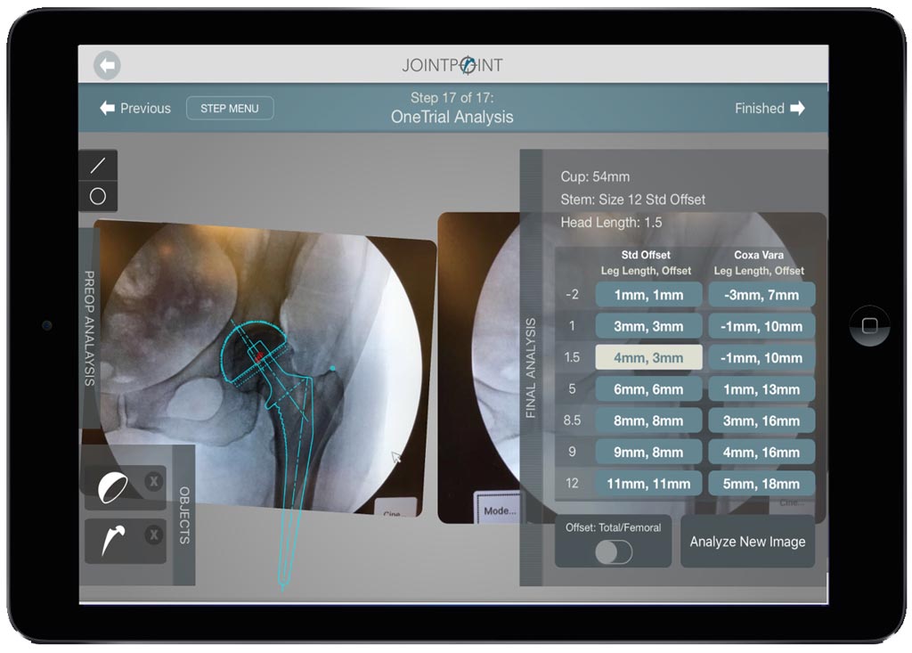 Imagen: El nuevo software de planificación se adapta perfectamente al flujo de trabajo quirúrgico ortopédico (Fotografía cortesía de JointPoint).