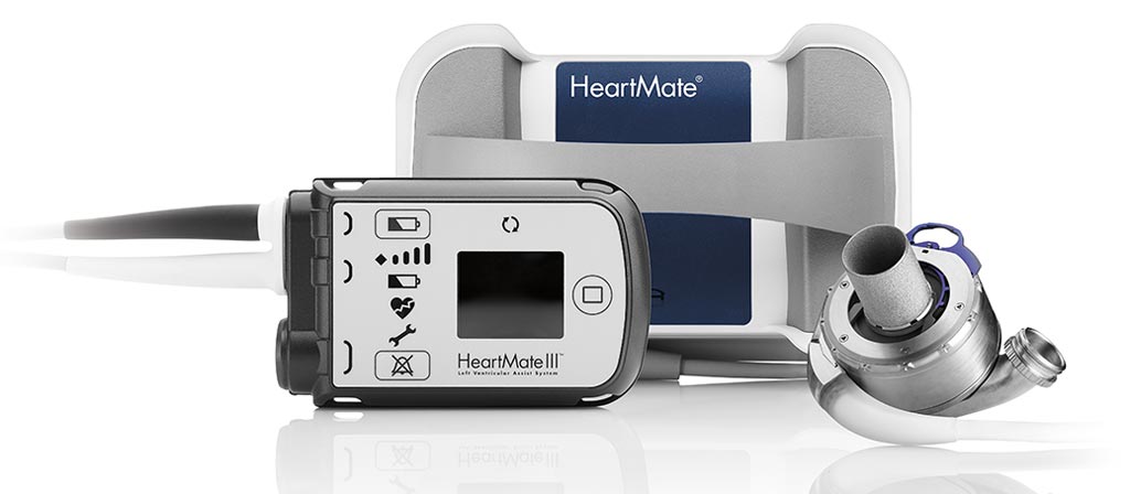 Imagen: El sistema completo MagLev HeartMate 3 LVAD (Fotografía cortesía de Abbott).